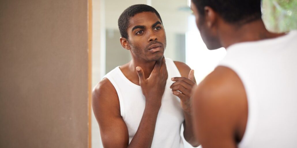 1623887360_How-to-Get-Rid-of-Acne-Scars.jpg